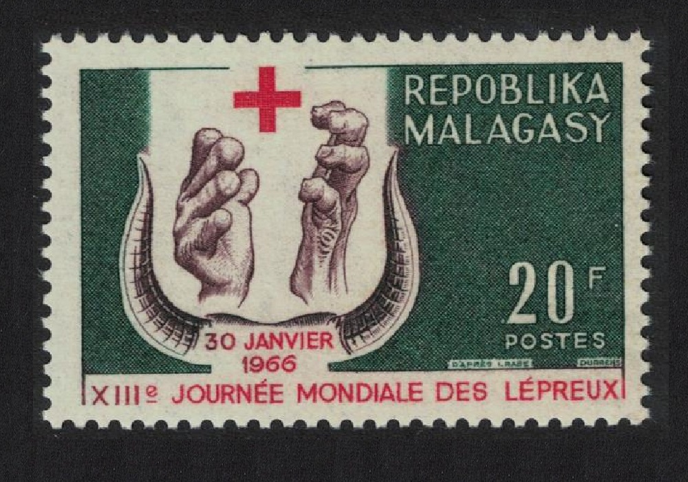 Malagasy Republic World Leprosy Day 1966 MNH SG#110